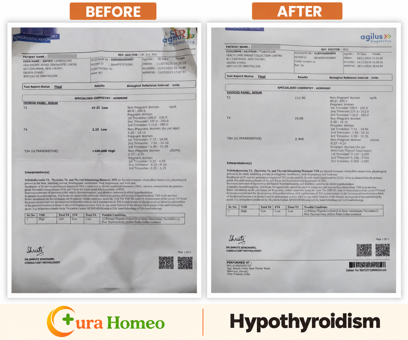 Thyroid reports — context needs clarification