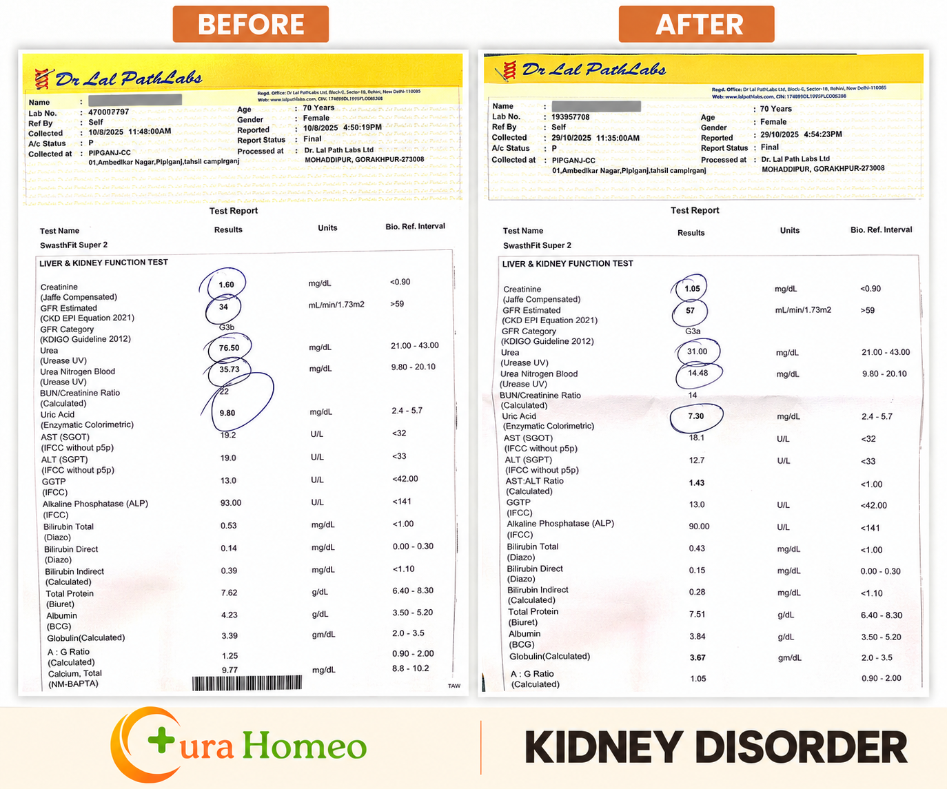 Kidney function
