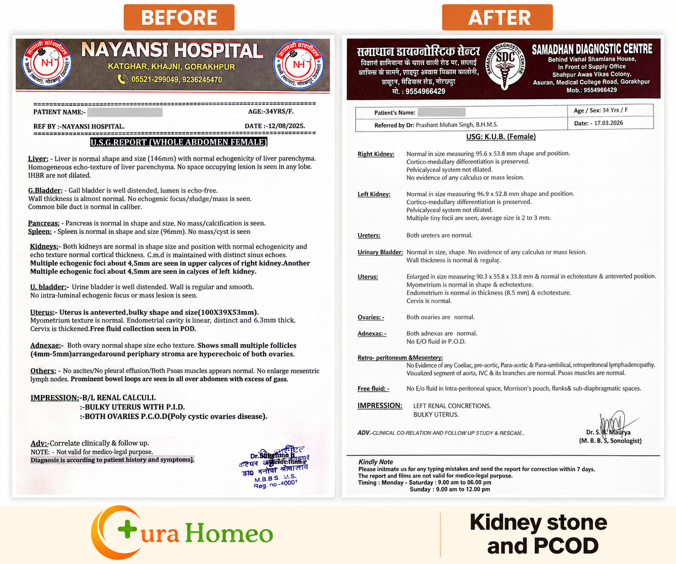 Renal and pelvic ultrasound