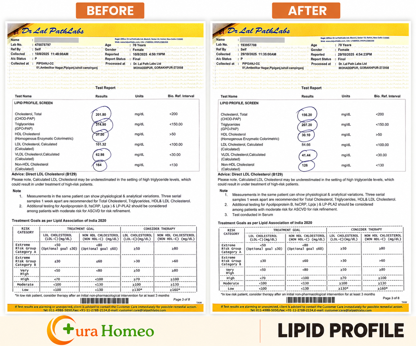 Lipid profile