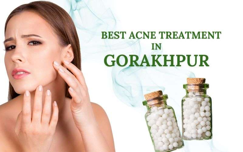 best homeopathic skin doctor in gorakhpur