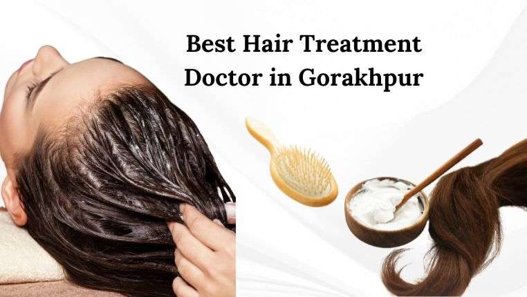 best hair treatment doctor in gorakhpur